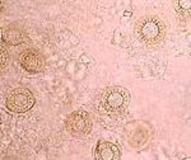 macro photo of trichodina gill disease